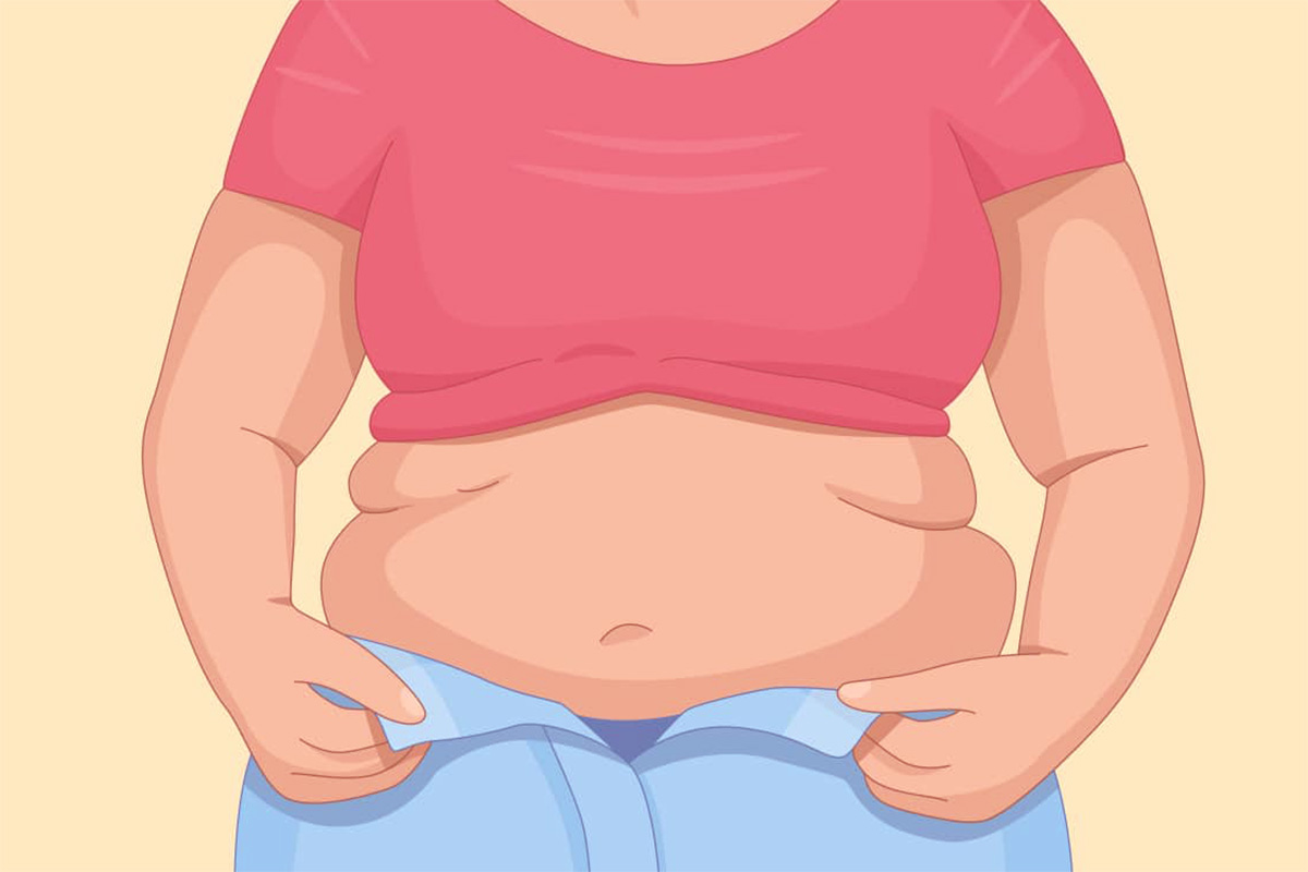 pcos belly shape