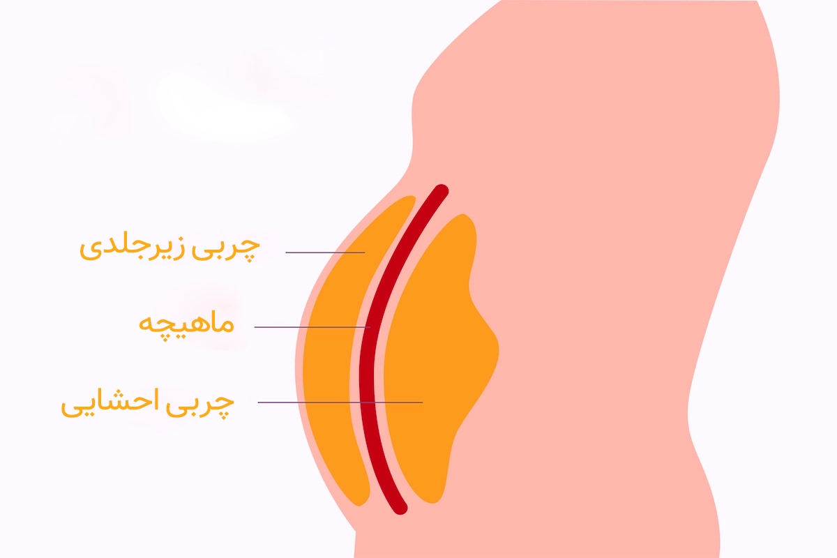 belly fat illus